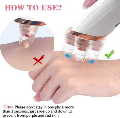 Blackhead Removal Machine