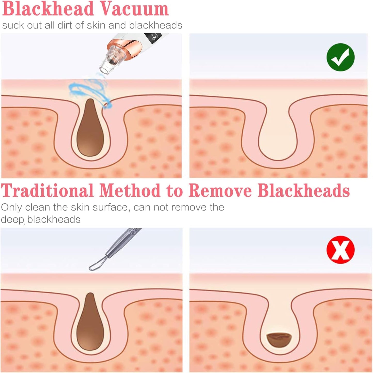 Blackhead Removal Machine